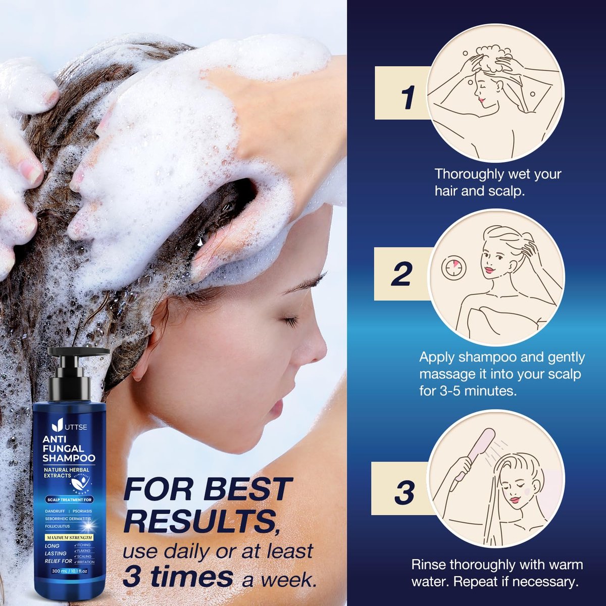Uttse Anti-Fungal Shampoo for Scalp Psoriasis, Dandruff, Folliculitis & Seborrheic Dermatitis – Relieves Itchy & Dry Scalp – 300 mL / 10.1 fl.oz Avelisse
