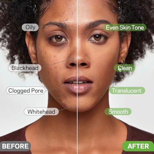 AMOADO Blackhead Remover Mask, Charcoal Peel Off Face Mask Kit (100g) – Deep Pore Cleansing, Oil Control, Blackheads Peel Off Mask for Men & Women – Includes Brush & Extractor Tool - görsel 12