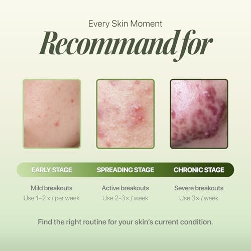 EIOM Trouble Patch Mask – Full Face Hydrocolloid Mask for Acne-Prone Skin | Absorbs Oil & Buildup with Tea Tree Biome Complex (20ml x 4) Avelisse
