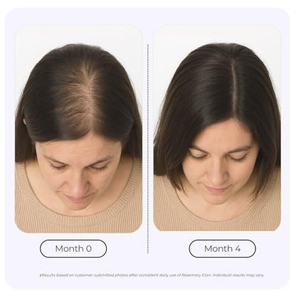Growplex Rosemary Elixir – Daily Scalp Oil with 9 Essential Oils – Lightweight, Non-Greasy Formula for a Healthy-Looking Scalp – For Men & Women – 2oz Avelisse