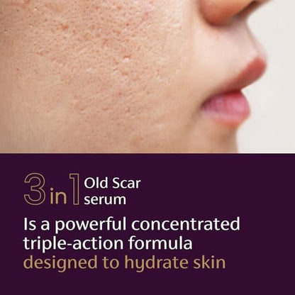 Mederma Scar Serum – Triple-Action Formula with Vitamin E, Hyaluronic Acid & Niacinamide – Clinically Shown to Reduce Old Scars, 1 Fl. Oz.
