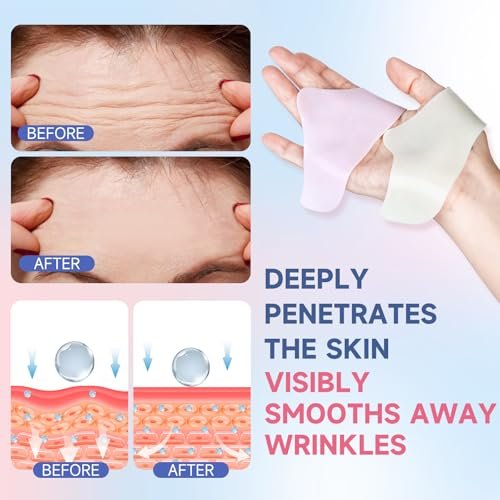 kindshine 40PCS Forehead Wrinkle Patches – Anti-Wrinkle Facial Patches with Hyaluronic Acid & Collagen, Overnight Forehead Wrinkle Smoothers Avelisse