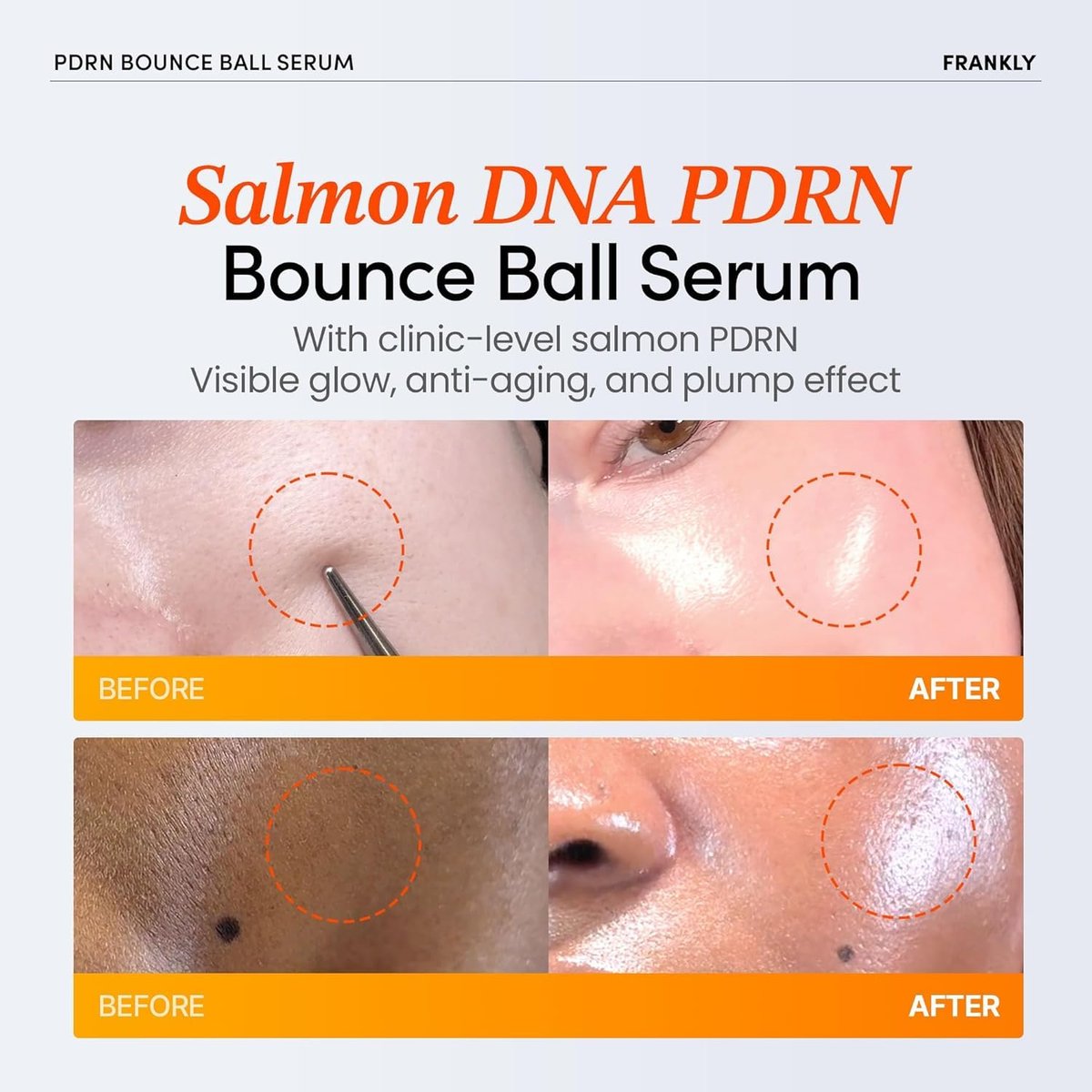 FRANKLY Salmon PDRN Bounce Ball Serum – 99% Pure Salmon DNA PDRN for Post Microneedling Recovery, Redness & Damaged Skin Repair | Glass Skin Korean Skincare | Lightweight, Non Sticky | 1.01 fl oz - görsel 5