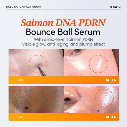 FRANKLY Salmon PDRN Bounce Ball Serum – 99% Pure Salmon DNA PDRN for Post Microneedling Recovery, Redness & Damaged Skin Repair | Glass Skin Korean Skincare | Lightweight, Non Sticky | 1.01 fl oz