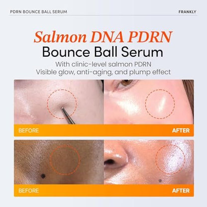 FRANKLY Salmon PDRN Bounce Ball Serum – 99% Pure Salmon DNA PDRN for Post Microneedling Recovery, Redness & Damaged Skin Repair | Glass Skin Korean Skincare | Lightweight, Non Sticky | 1.01 fl oz