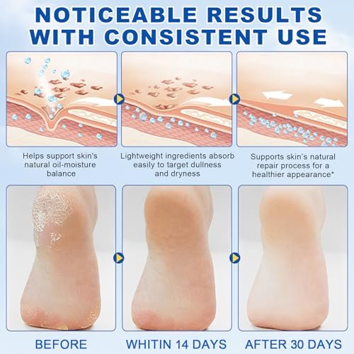 60% Urea with 2% Salicylic Acid Urea Foot Care Stick - 1.41 oz, Moisturizer for Dry Cracked Feet, Knees, Elbows, Hands, Callus Remover & Skin Softener - görsel 9