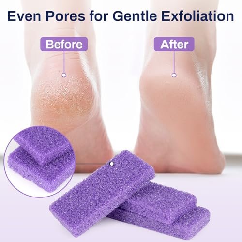 RAQEHO 20 Small Pumice Stone for Feet - 3.6 x 1.8 x 0.47 Inch Purple Foot Pumice Stone Foot Filer Pedicure Scrubber for Callus Removal Foot Care Spa Products for Dark Elbows Hard Skin Exfoliating - görsel 10