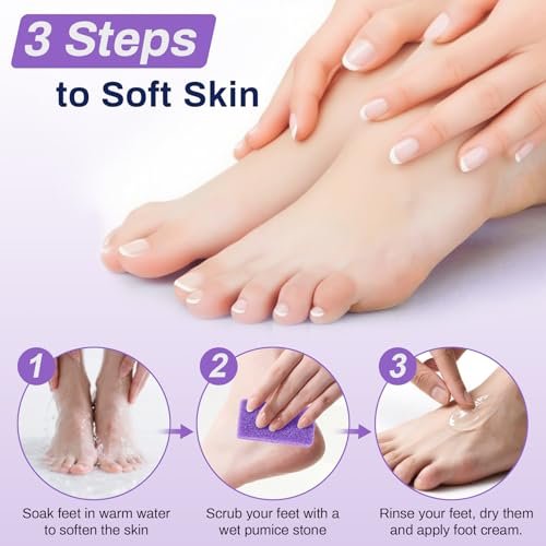 RAQEHO 20 Small Pumice Stone for Feet - 3.6 x 1.8 x 0.47 Inch Purple Foot Pumice Stone Foot Filer Pedicure Scrubber for Callus Removal Foot Care Spa Products for Dark Elbows Hard Skin Exfoliating - görsel 12