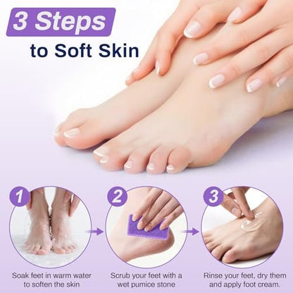 RAQEHO 20 Small Pumice Stone for Feet - 3.6 x 1.8 x 0.47 Inch Purple Foot Pumice Stone Foot Filer Pedicure Scrubber for Callus Removal Foot Care Spa Products for Dark Elbows Hard Skin Exfoliating