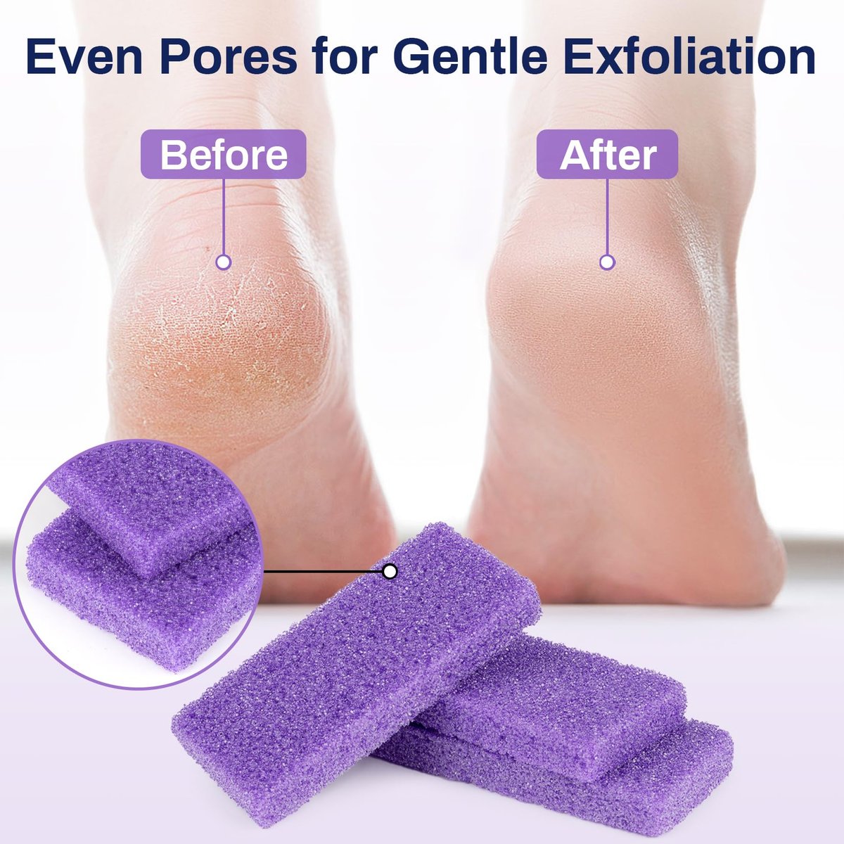 RAQEHO 20 Small Pumice Stone for Feet - 3.6 x 1.8 x 0.47 Inch Purple Foot Pumice Stone Foot Filer Pedicure Scrubber for Callus Removal Foot Care Spa Products for Dark Elbows Hard Skin Exfoliating - görsel 9