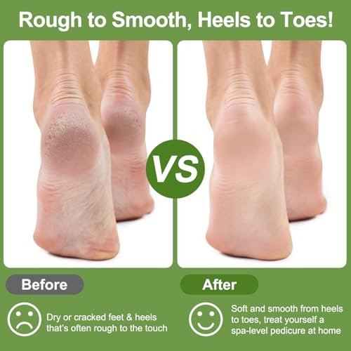 KuuCare Natural Pumice Stone for Feet, 3 Pack - Earth Lava Foot Callus Remover & Pedicure Exfoliator for Heels, Soles, and Toe Gaps - Foot Scrubber for Dry & Dead Skin Avelisse