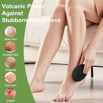 KuuCare Natural Pumice Stone for Feet, 3 Pack - Earth Lava Foot Callus Remover & Pedicure Exfoliator for Heels, Soles, and Toe Gaps - Foot Scrubber for Dry & Dead Skin Avelisse
