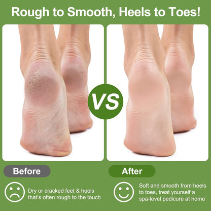 KuuCare Natural Pumice Stone for Feet, 3 Pack - Earth Lava Foot Callus Remover & Pedicure Exfoliator for Heels, Soles, and Toe Gaps - Foot Scrubber for Dry & Dead Skin Avelisse
