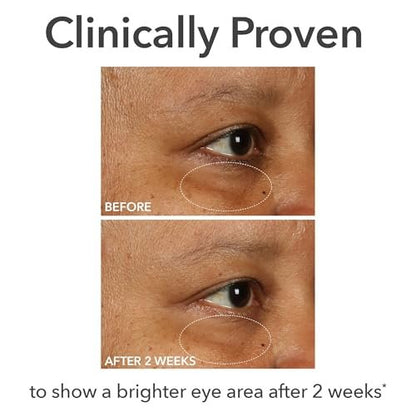 Dr Dennis Gross DermInfusions Fill + Repair Eye Cream – Hydrating & Brightening Treatment for Dark Circles, Fine Lines & Wrinkles, Firms & Smooths 360° Eye Area, 0.5 Oz Avelisse