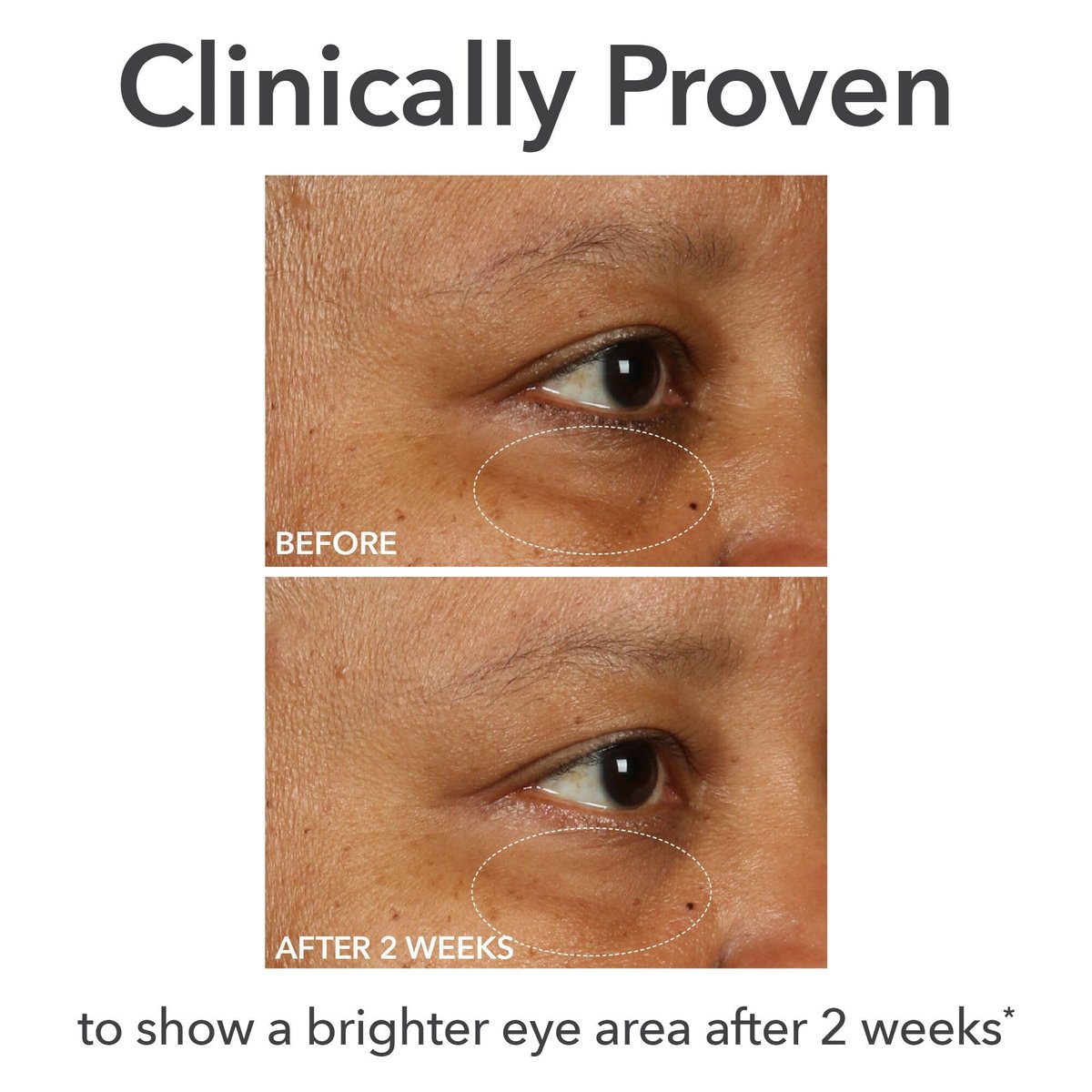 Dr Dennis Gross DermInfusions Fill + Repair Eye Cream – Hydrating & Brightening Treatment for Dark Circles, Fine Lines & Wrinkles, Firms & Smooths 360° Eye Area, 0.5 Oz Avelisse