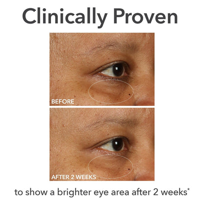 Dr Dennis Gross DermInfusions Fill + Repair Eye Cream – Hydrating & Brightening Treatment for Dark Circles, Fine Lines & Wrinkles, Firms & Smooths 360° Eye Area, 0.5 Oz Avelisse