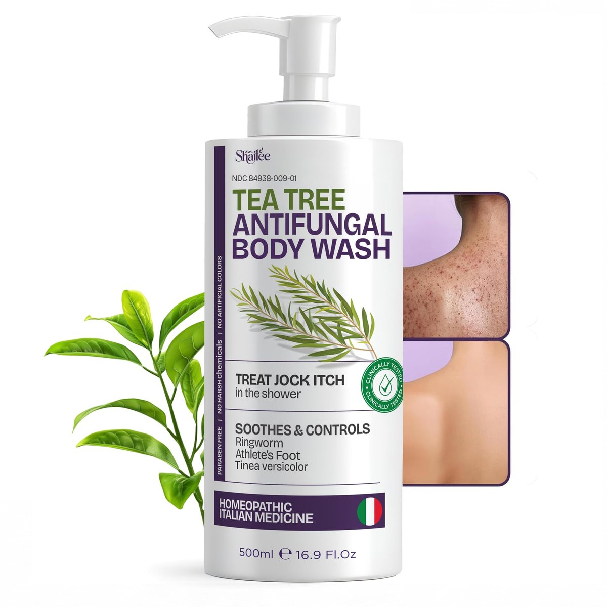 Shailee Antifungal Body Wash with Tea Tree Oil – 1% Tolnaftate for Ringworm, Back Acne, Jock Itch & Eczema – Antifungal Soap for Men & Women, 16.9 oz Avelisse