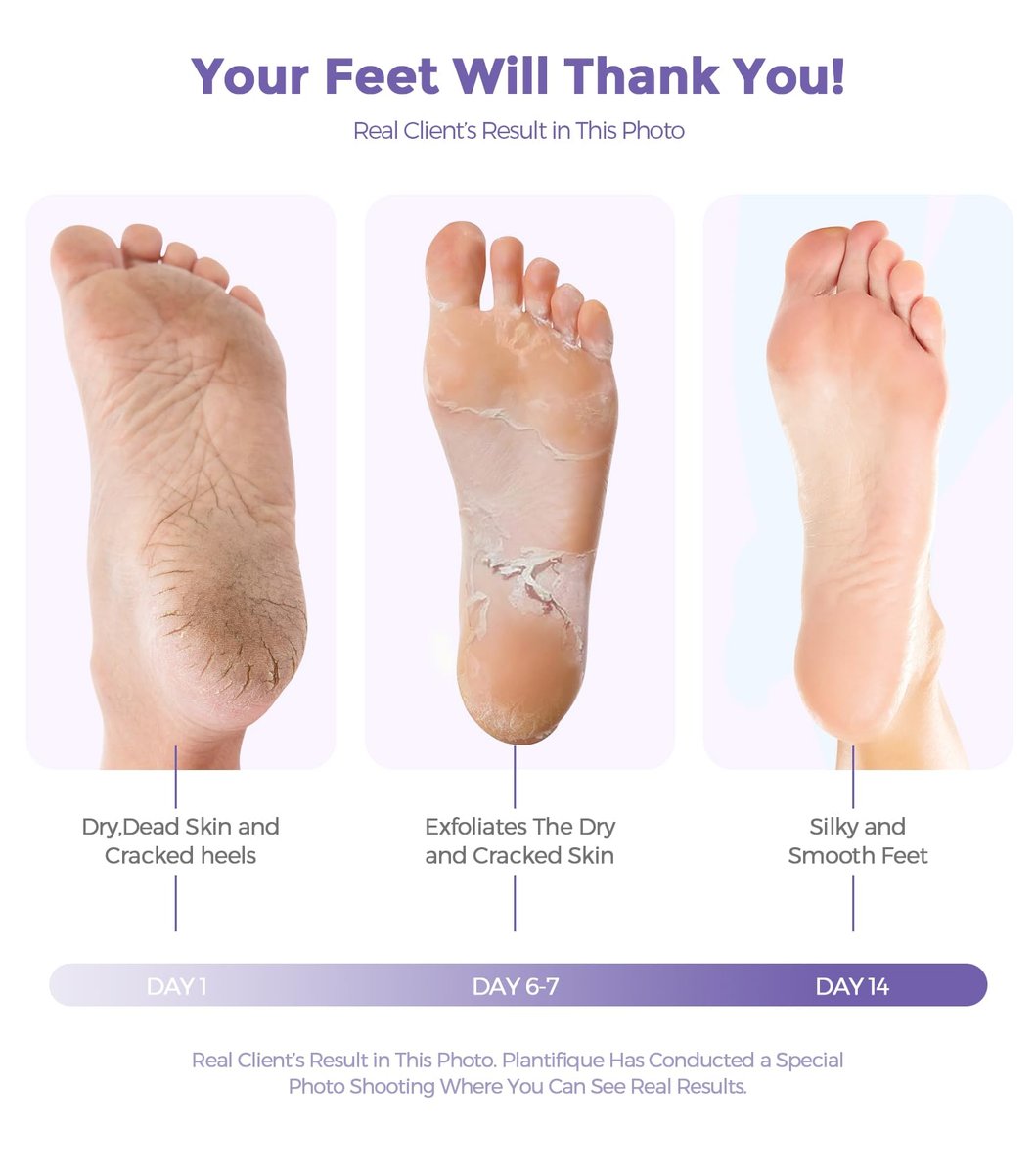 Lavender Foot Peel Mask – Natural Exfoliator for Dry Dead Skin, Calluses & Cracked Heels – 2 Count - görsel 9