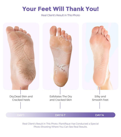 Lavender Foot Peel Mask – Natural Exfoliator for Dry Dead Skin, Calluses & Cracked Heels – 2 Count