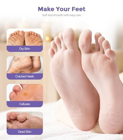 Lavender Foot Peel Mask – Natural Exfoliator for Dry Dead Skin, Calluses & Cracked Heels – 2 Count