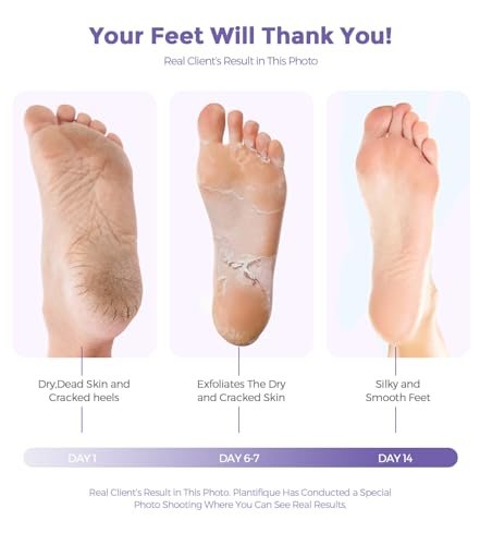 Lavender Foot Peel Mask – Natural Exfoliator for Dry Dead Skin, Calluses & Cracked Heels – 2 Count - görsel 10