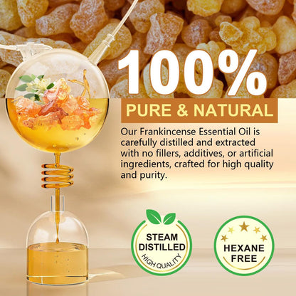Shuangjia Frankincense Resin Oil for Face 2.02 fl.oz – Anti-Aging Serum Reduces Fine Lines & Wrinkles, Soothes & Repairs Skin, Deep Hydration for Body Avelisse