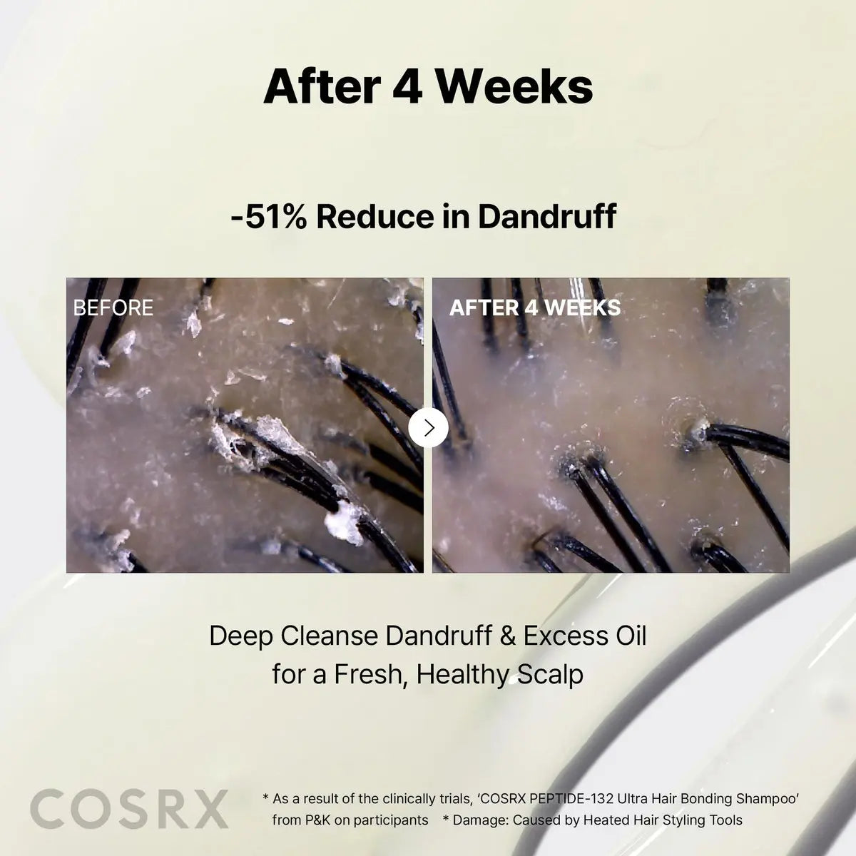 COSRX Peptide 132 Hair Bonding Shampoo - Daily Scalp Treatment for Dandruff, Repairs & Strengthens All Dry and Damaged Hair Types - 6.76 fl oz Avelisse