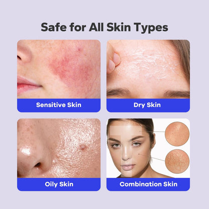 SilkyShark 2% Salicylic Acid Body Spray - Back Acne Treatment Spray for Chest, Shoulders & Face (5.07 Fl Oz), Body Acne Spray for Blackheads & Breakouts, 360° Continuous Mist, Fast-Absorbing Formula