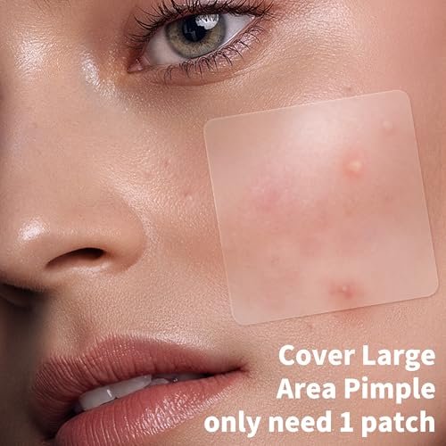 Daolyo Large Pimple Patches for Face, 7 Sizes 210 Counts XL Acne Patches, Big Hydrocolloid Bandages for Body, Chin, Forehead, Chest, Back Zit Breakouts (Strip, Square, Round) Avelisse