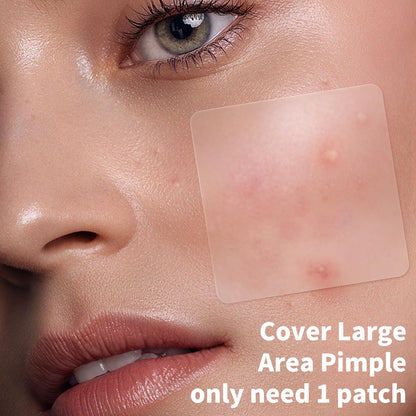 Daolyo Large Pimple Patches for Face, 7 Sizes 210 Counts XL Acne Patches, Big Hydrocolloid Bandages for Body, Chin, Forehead, Chest, Back Zit Breakouts (Strip, Square, Round) Avelisse