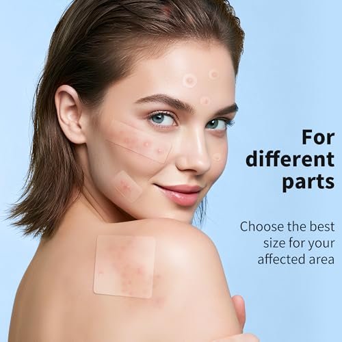 Daolyo Large Pimple Patches for Face, 7 Sizes 210 Counts XL Acne Patches, Big Hydrocolloid Bandages for Body, Chin, Forehead, Chest, Back Zit Breakouts (Strip, Square, Round) Avelisse
