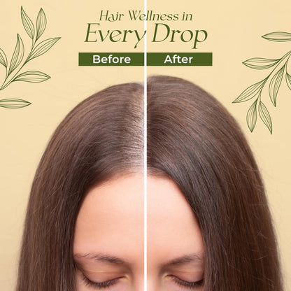 Veganic Natural Hair Growth Oil for Women - Infused with 10 Premium Botanic Oils & Organic Rosemary Oil for Hair Growth, Salon-Grade Volumizing & Nourishment, Non-GMO Verified, 30-Day Supply Avelisse