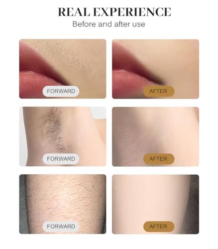2025 Professional Hair Removal Machine - Light-Based IPL for Smooth Skin, Black and Gold - görsel 14