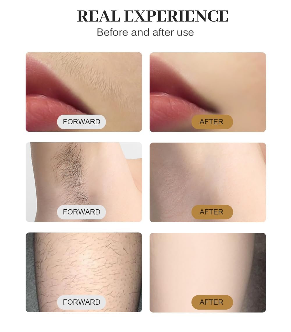 2025 Professional Hair Removal Machine - Light-Based IPL for Smooth Skin, Black and Gold - görsel 13