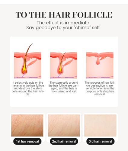 2025 Professional Hair Removal Machine - Light-Based IPL for Smooth Skin, Black and Gold - görsel 16