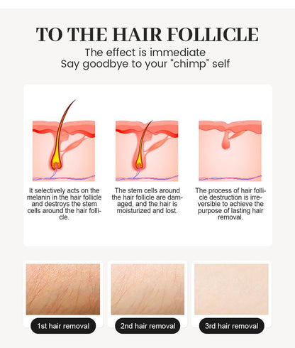 2025 Professional Hair Removal Machine - Light-Based IPL for Smooth Skin, Black and Gold