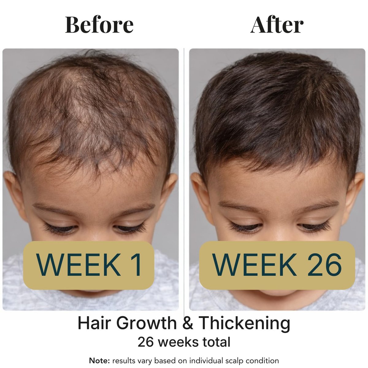 Revatology Kids & Baby Hair Growth Oil – Gentle Pre-Wash Dry/Itchy Scalp Treatment with Coconut, Rosemary, Castor, Amla +25 Botanicals, Ayurvedic, Made in USA, 1 Fl Oz Avelisse
