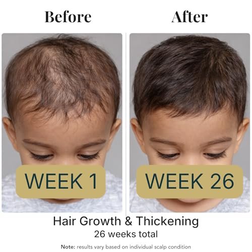 Revatology Kids & Baby Hair Growth Oil – Gentle Pre-Wash Dry/Itchy Scalp Treatment with Coconut, Rosemary, Castor, Amla +25 Botanicals, Ayurvedic, Made in USA, 1 Fl Oz Avelisse