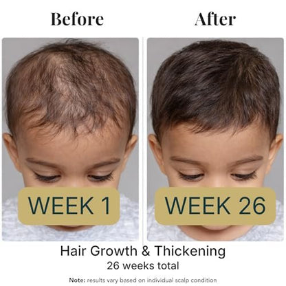 Revatology Kids & Baby Hair Growth Oil – Gentle Pre-Wash Dry/Itchy Scalp Treatment with Coconut, Rosemary, Castor, Amla +25 Botanicals, Ayurvedic, Made in USA, 1 Fl Oz Avelisse