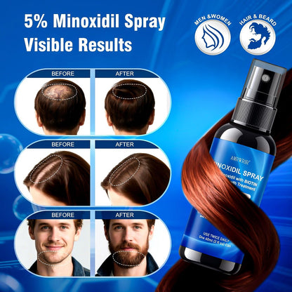 5% Minoxidil Spray for Men and Women with Biotin – Hair Growth Treatment for Thicker Fuller Hair & Beard (6 Pack, 12 Fl Oz Total, 6 Month Supply) Avelisse