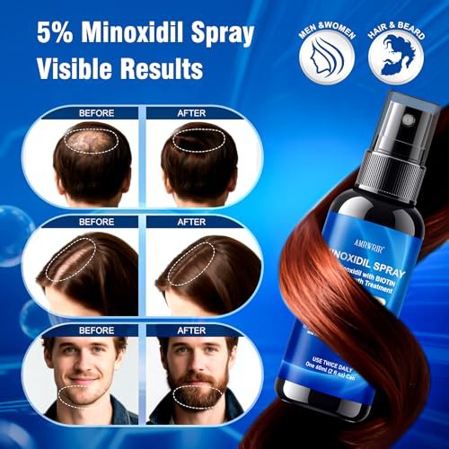 5% Minoxidil Spray for Men and Women with Biotin – Hair Growth Treatment for Thicker Fuller Hair & Beard (6 Pack, 12 Fl Oz Total, 6 Month Supply) Avelisse