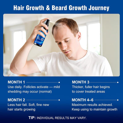 5% Minoxidil Spray for Men and Women with Biotin – Hair Growth Treatment for Thicker Fuller Hair & Beard (6 Pack, 12 Fl Oz Total, 6 Month Supply) Avelisse