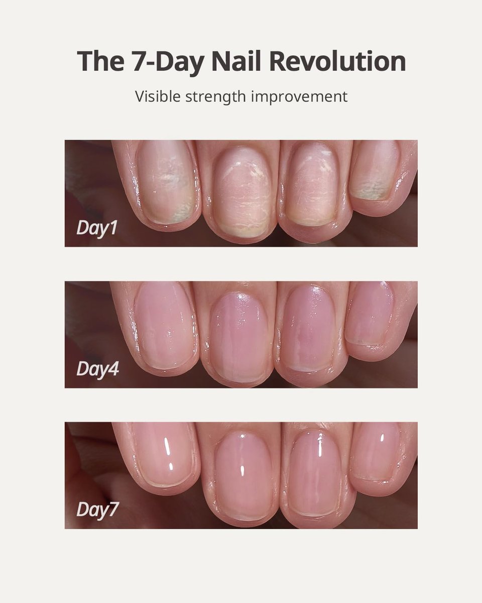 BTArtboxnails Naillush Nail Strengthener & Growth - Repair Damaged Nails, Strengthen Weak & Thin Nails, Extra Strong Nail Growth Treatment, Long Lasting Nail Hardener, 15ml Avelisse