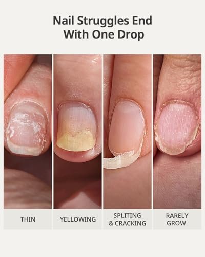 BTArtboxnails Naillush Nail Strengthener & Growth - Repair Damaged Nails, Strengthen Weak & Thin Nails, Extra Strong Nail Growth Treatment, Long Lasting Nail Hardener, 15ml Avelisse