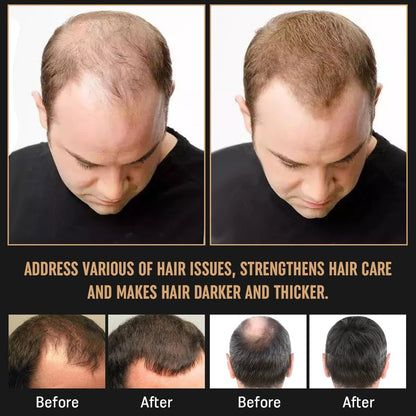2Pcs Root Activator Shampoo – Hair Growth Shampoo for Men and Women – Natural Formula for Hair Loss and Thinning Hair (3.38 Fl Oz, Pack of 2) Avelisse