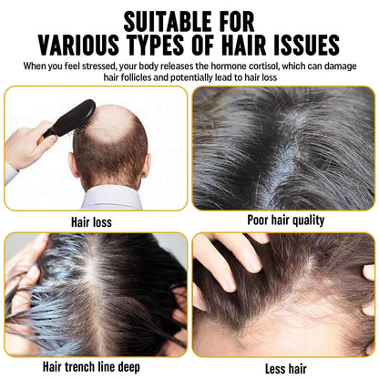 2Pcs Root Activator Shampoo – Hair Growth Shampoo for Men and Women – Natural Formula for Hair Loss and Thinning Hair (3.38 Fl Oz, Pack of 2) Avelisse
