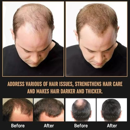 2Pcs Root Activator Shampoo – Hair Growth Shampoo for Men and Women – Natural Formula for Hair Loss and Thinning Hair (3.38 Fl Oz, Pack of 2) Avelisse