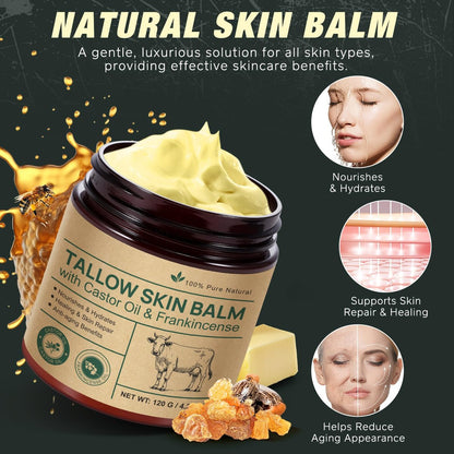Organic Whipped Beef Tallow Balm with Castor Oil & Frankincense – Deep Moisturizing Face & Body Cream, 4.2 oz (120g) Avelisse