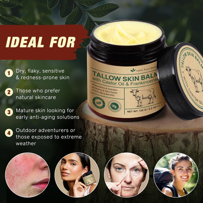 Organic Whipped Beef Tallow Balm with Castor Oil & Frankincense – Deep Moisturizing Face & Body Cream, 4.2 oz (120g) Avelisse