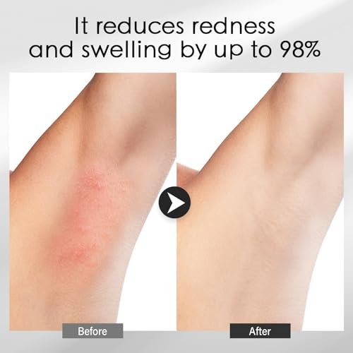 Cooling Gel for Hair Removal Devices – 300g Soothing Conductive Gel with Aloe Vera & Centella Asiatica for Face, Body, Legs, Arms, Underarms – Men & Women - görsel 10